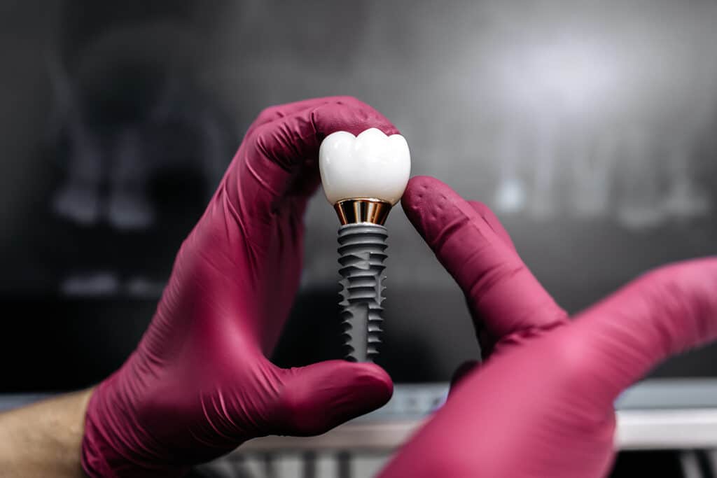 Dental Implant Aftercare Tips from a Vernon Hills, IL Dentist