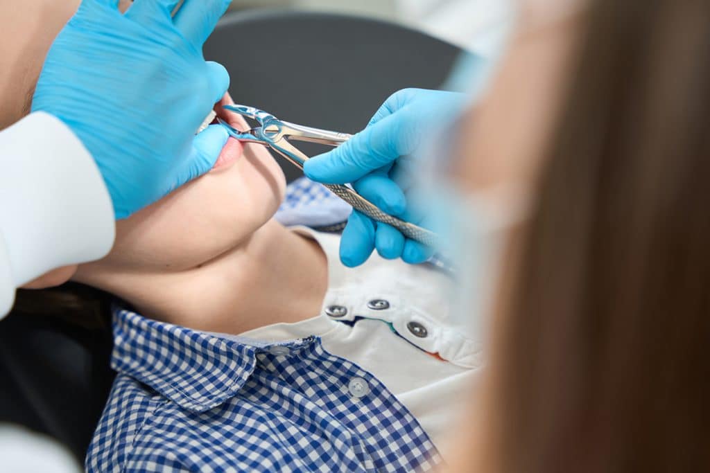 Why Tooth Extractions Are Sometimes Necessary in Vernon Hills, IL